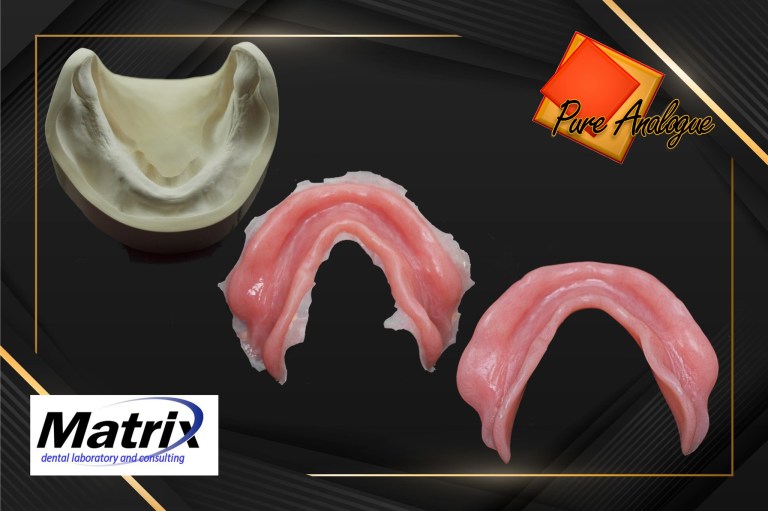 Removable Prosthetics 3 Decades of Technique LMT 2024 presentation