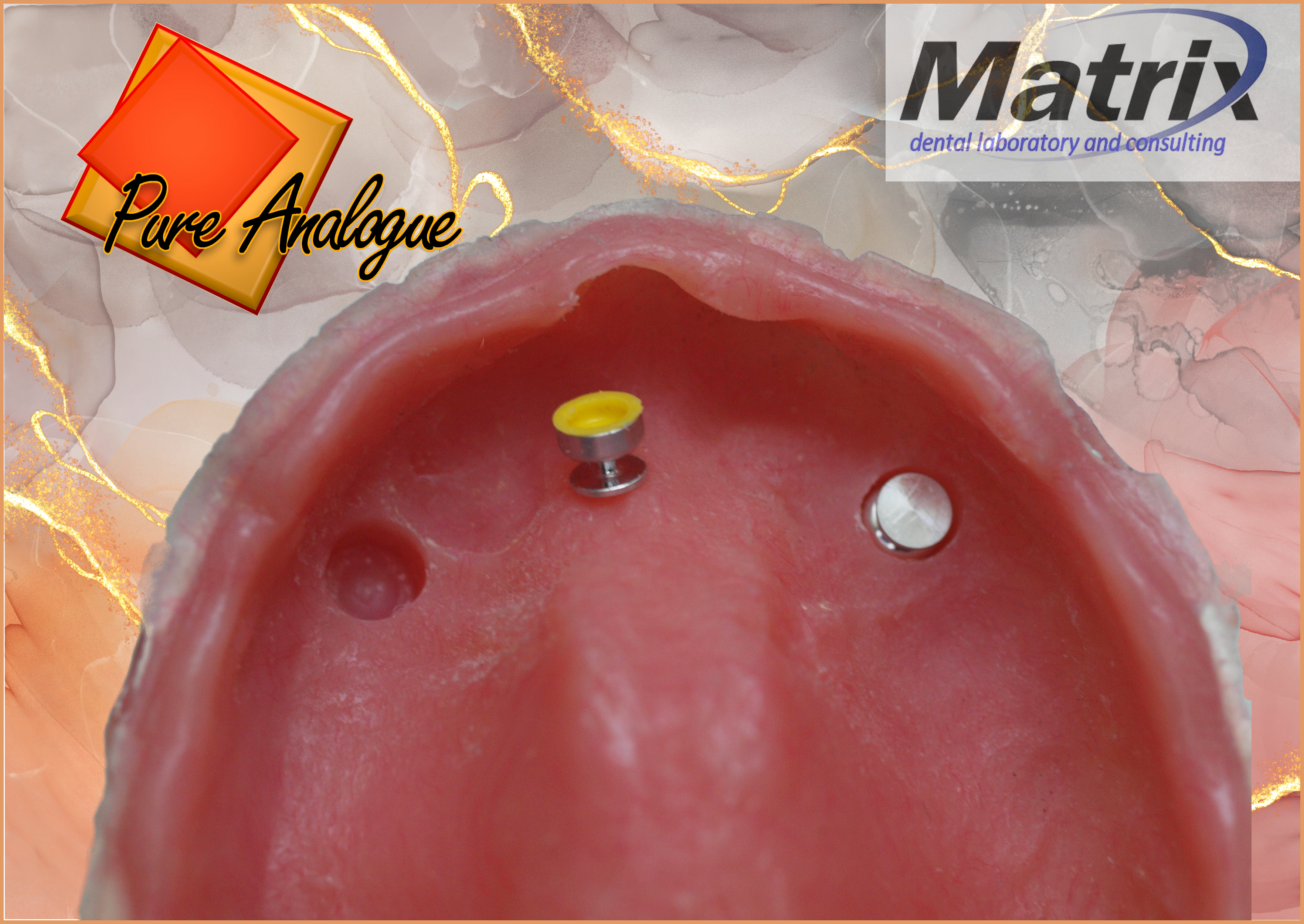 Locator Matrix Part Thinking Inside the Box – Matrix Dental Laboratory and Consulting