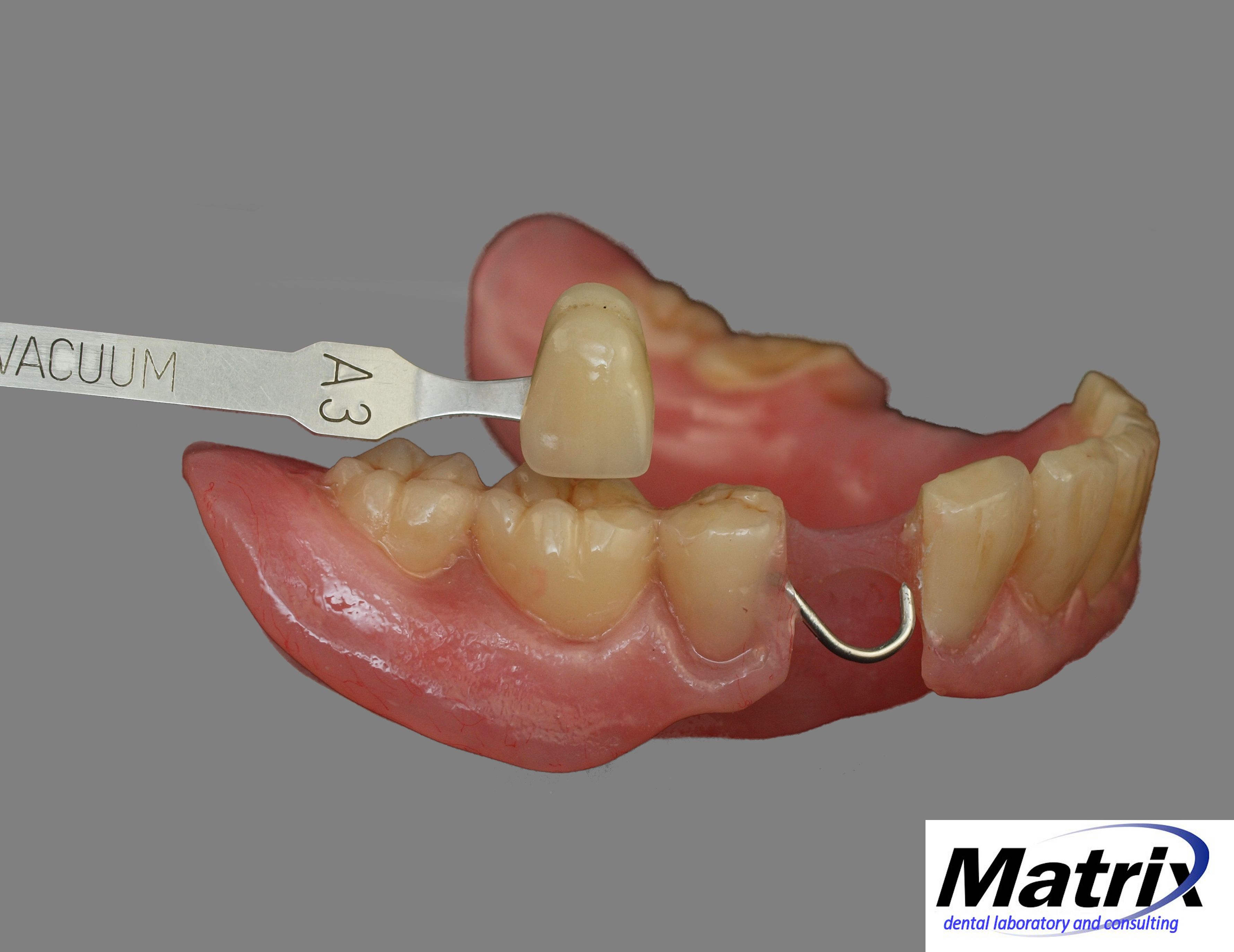 It’s Always About the Patient – Matrix Dental Laboratory and Consulting